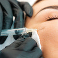 Mesotherapy - Clinique Esthétique HoMa
