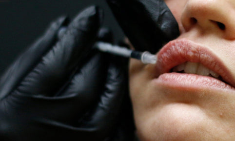 The Difference between Lip Fillers and Lip Flip - Clinique Esthétique HoMa