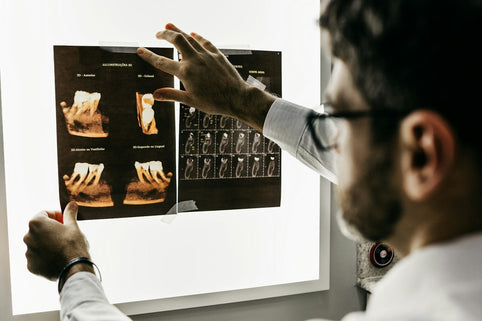 Montreal med spa consultation for la reduction du double menton